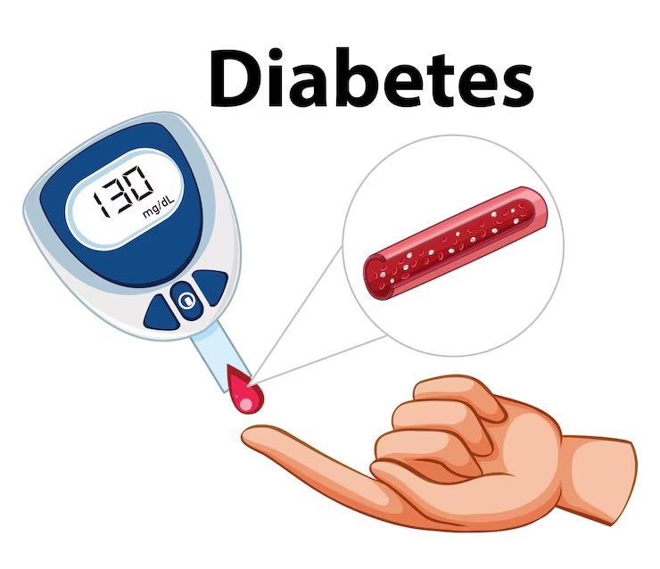 Kenali Jenis, Gejala, Penanganan, Hingga Pencegahan Diabetes